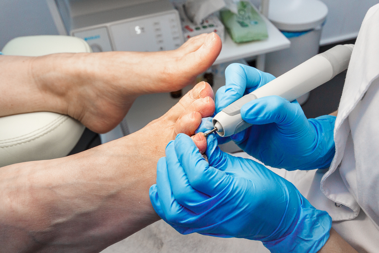 Аппаратный педикюр