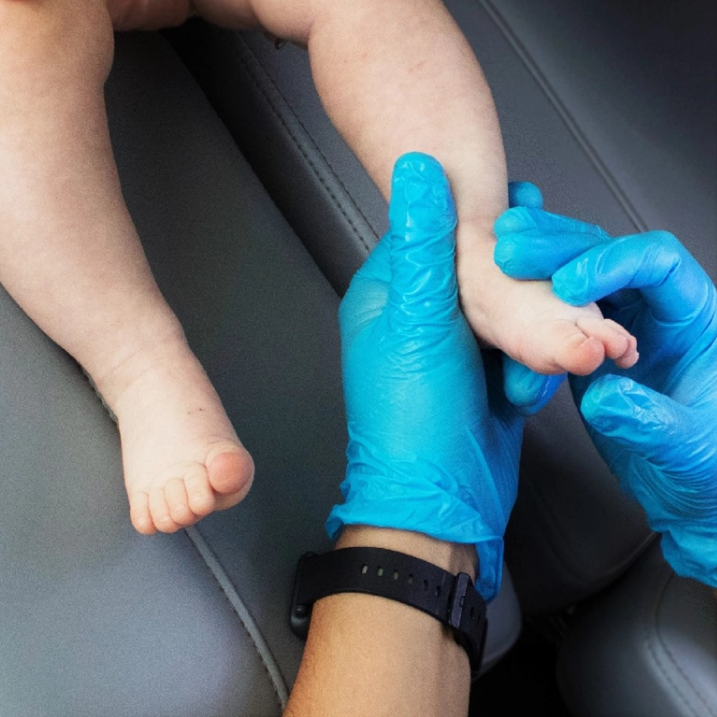 Грибок ногтей у детей, обработка