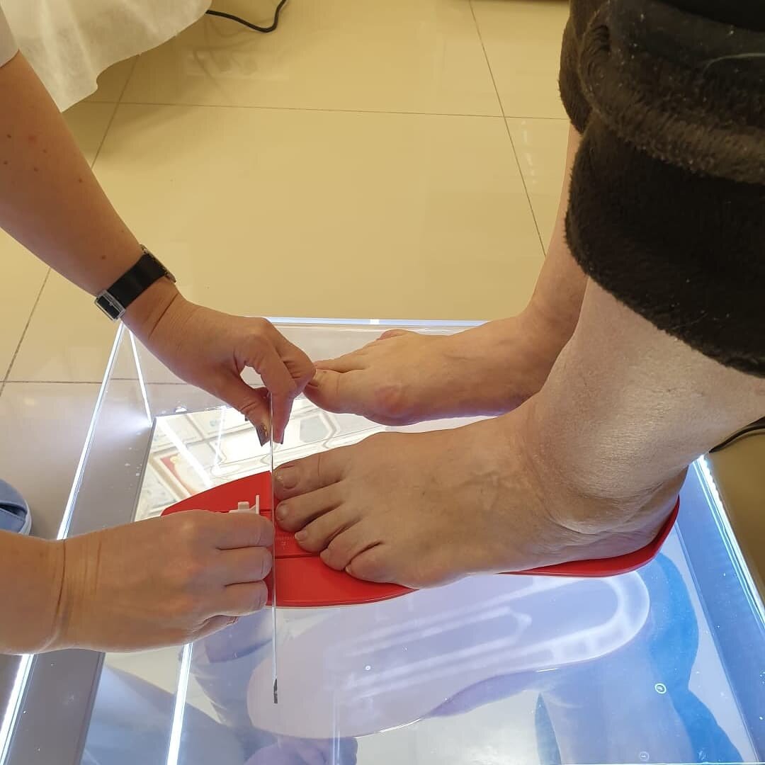 Изготовление индивидуальных анатомических стелек