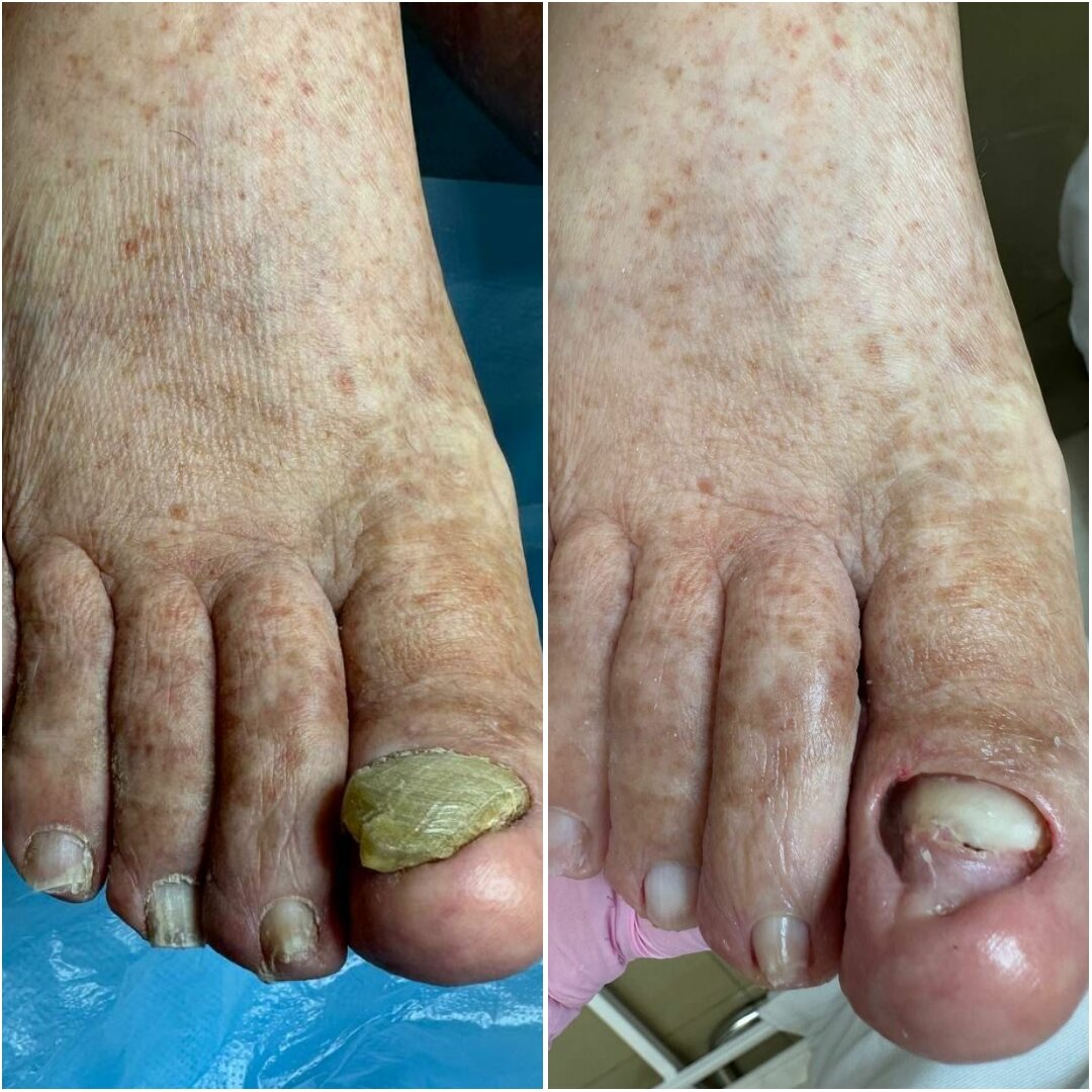 Педикюр с выездом на дом