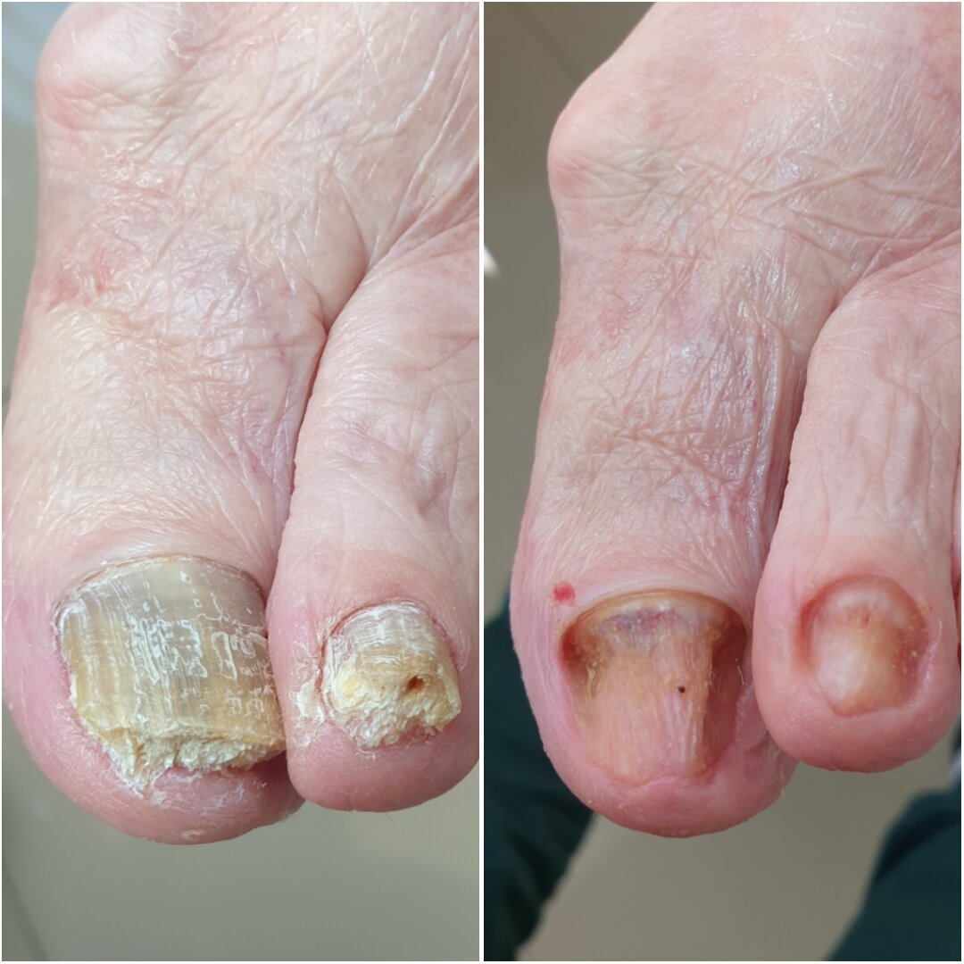 Педикюр с выездом на дом