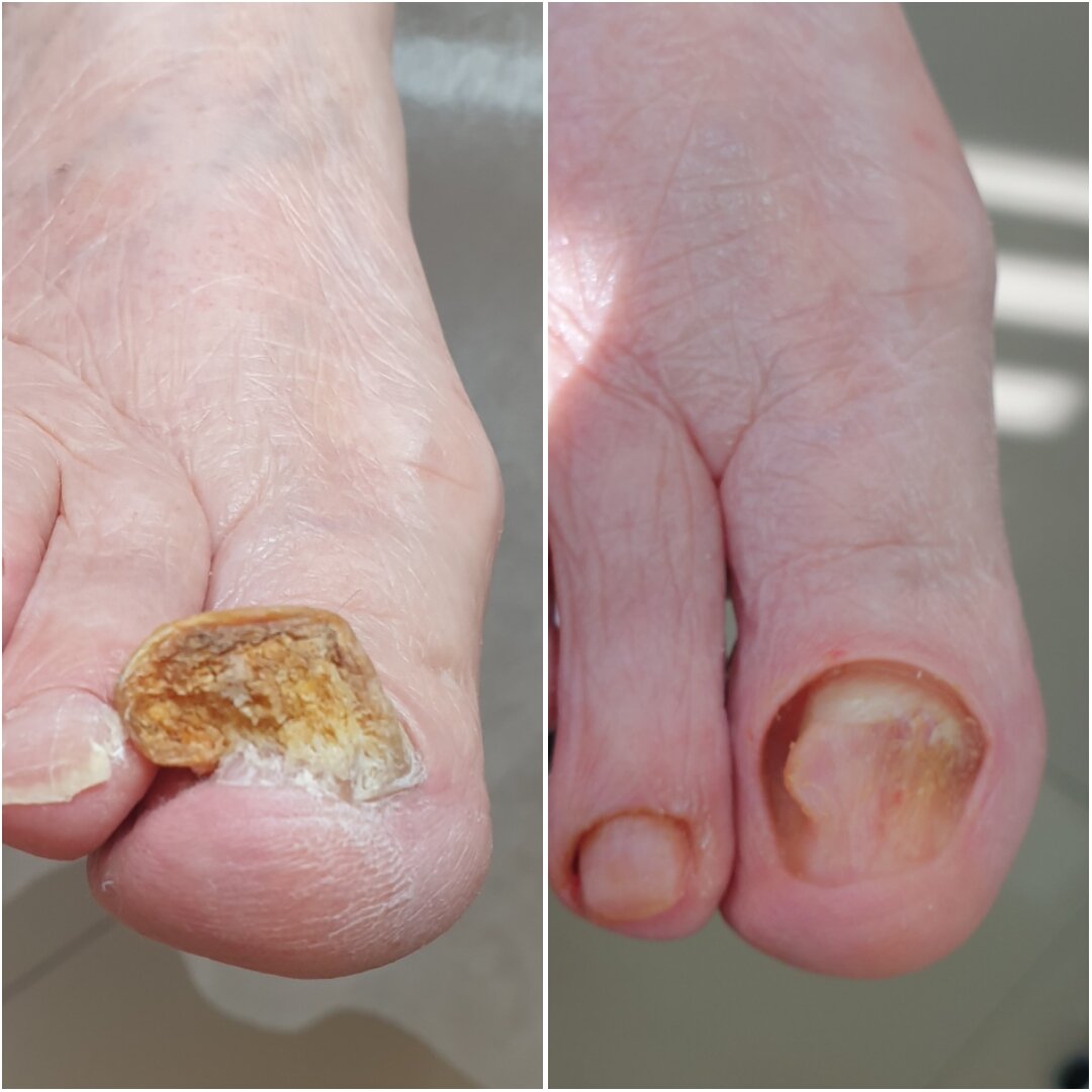 Педикюр с выездом на дом