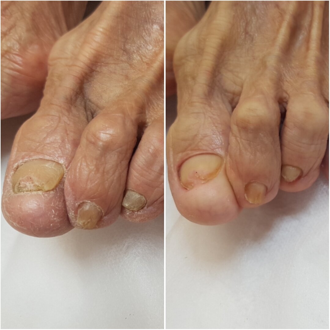 Педикюр с выездом на дом