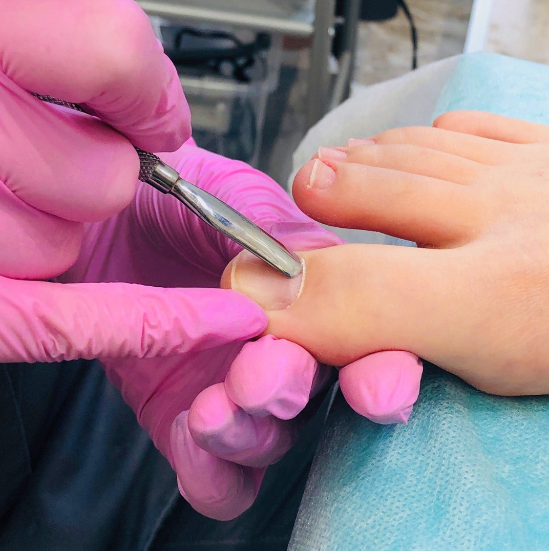 Классический педикюр