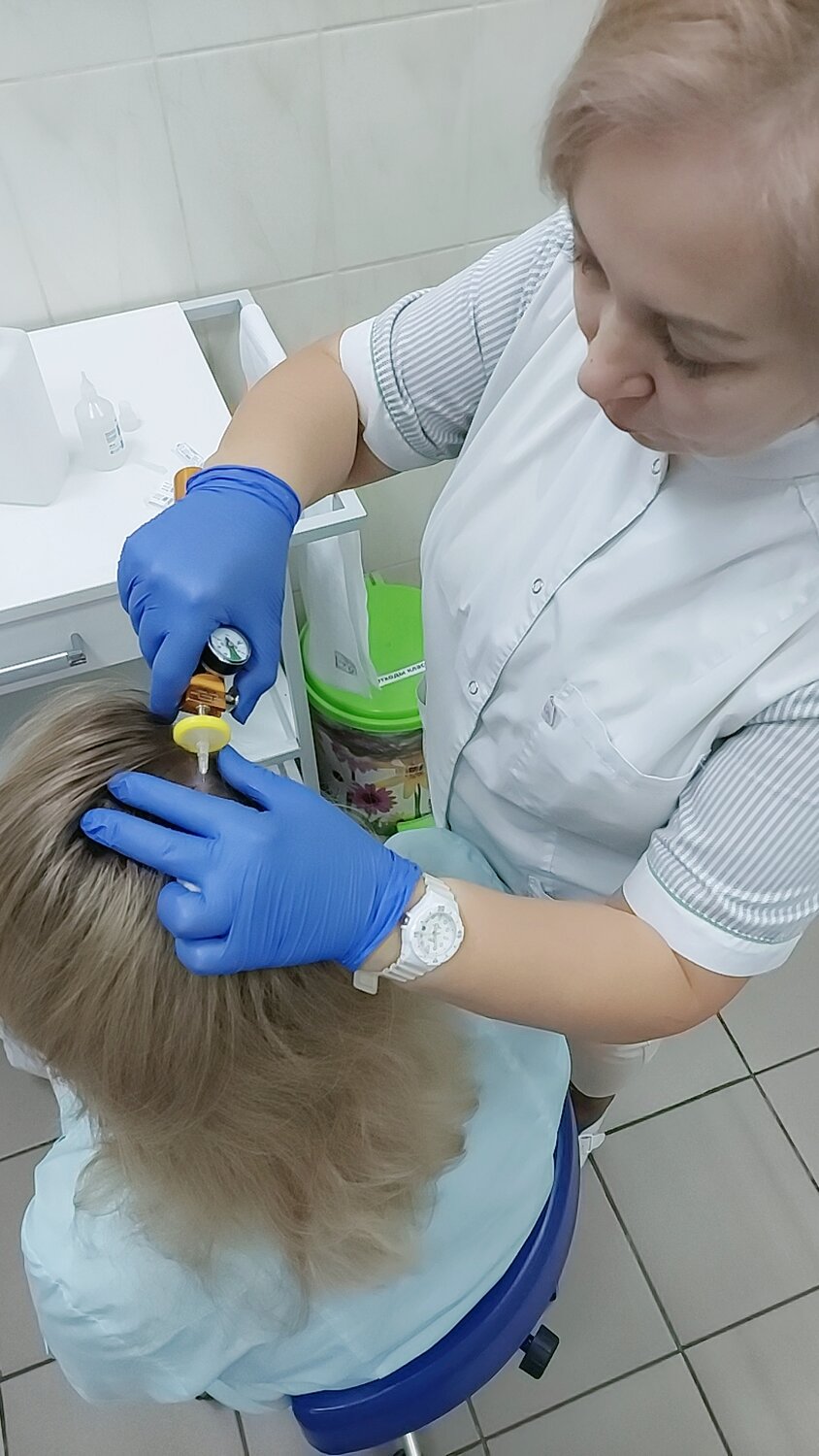 Карбокситерапия волос