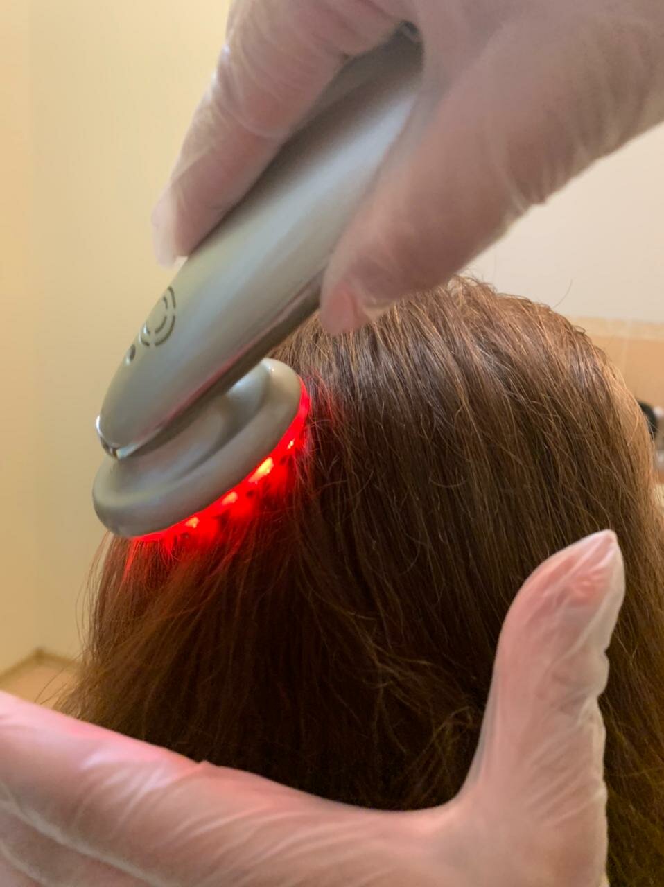 Лазеротерапия волос
