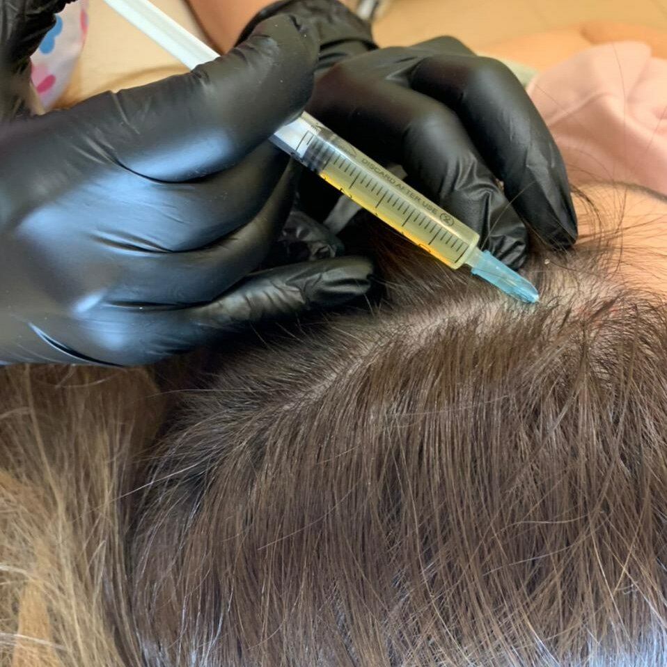 Плазмолифтинг волос