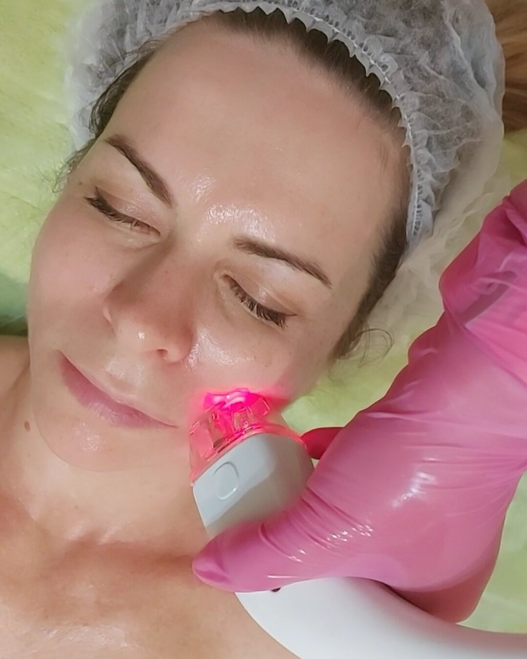 Vella Shape для лица